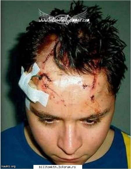 tokio hotel was involved in a fight again. this time it happened to drummer gustav. allegedly, a